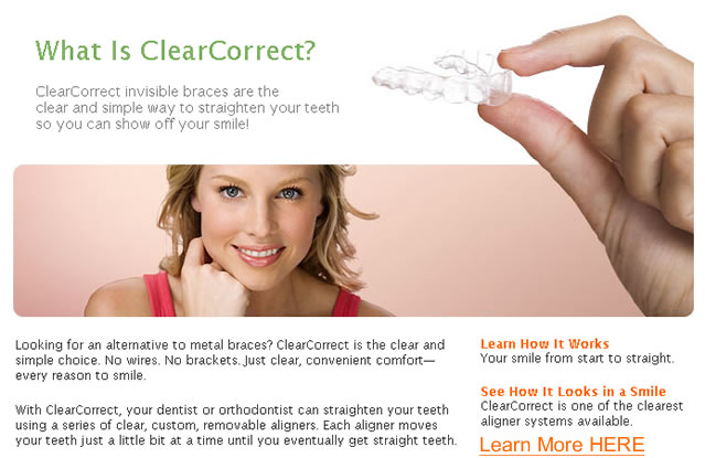 ClearCorrect Invisable Braces